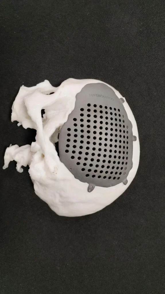 3D Printed Model