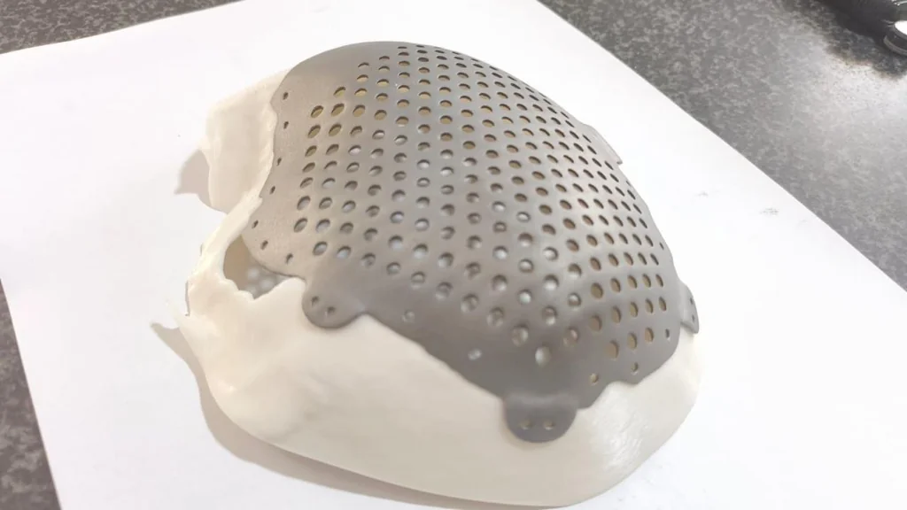 3D Printed Cranial Model Side