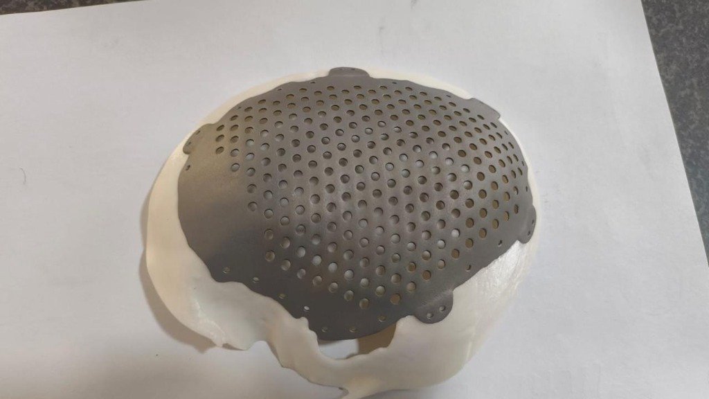 3D Printed Cranial Model Top