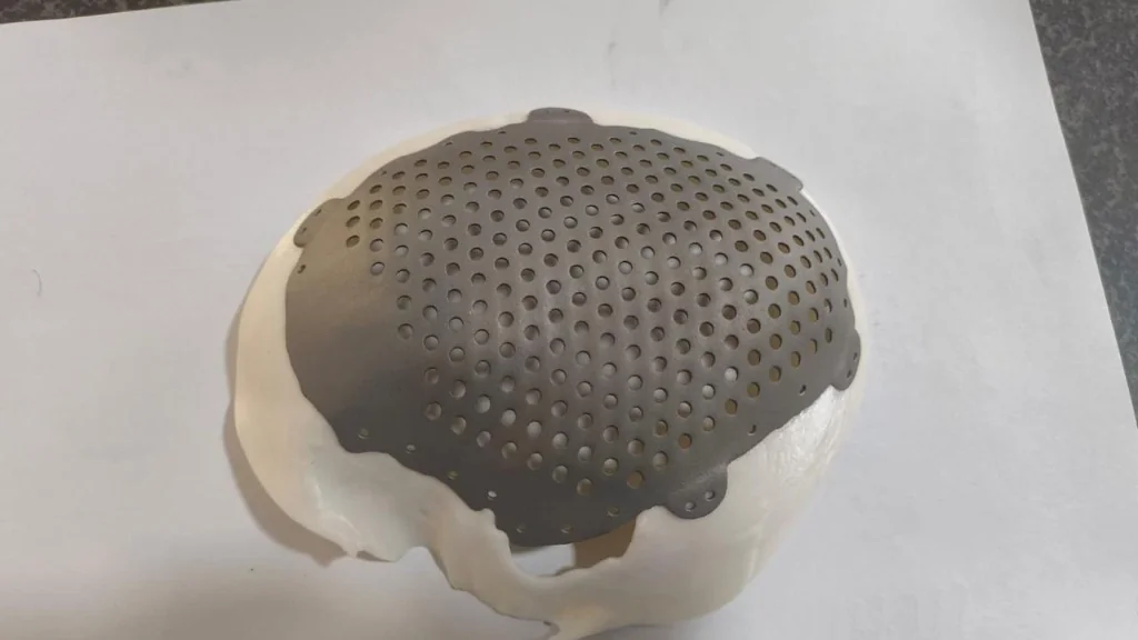 3D Printed Cranial Model Top