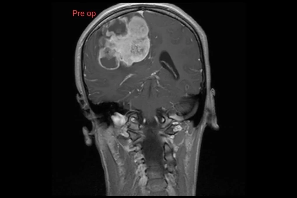 Paediatric MRI Axial