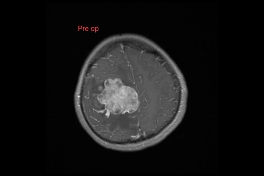 Paediatric MRI Coronal