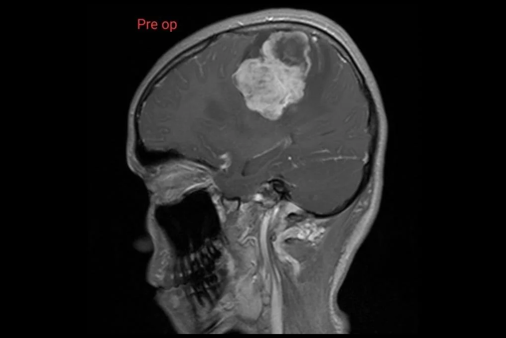Paediatric MRI Sagittal